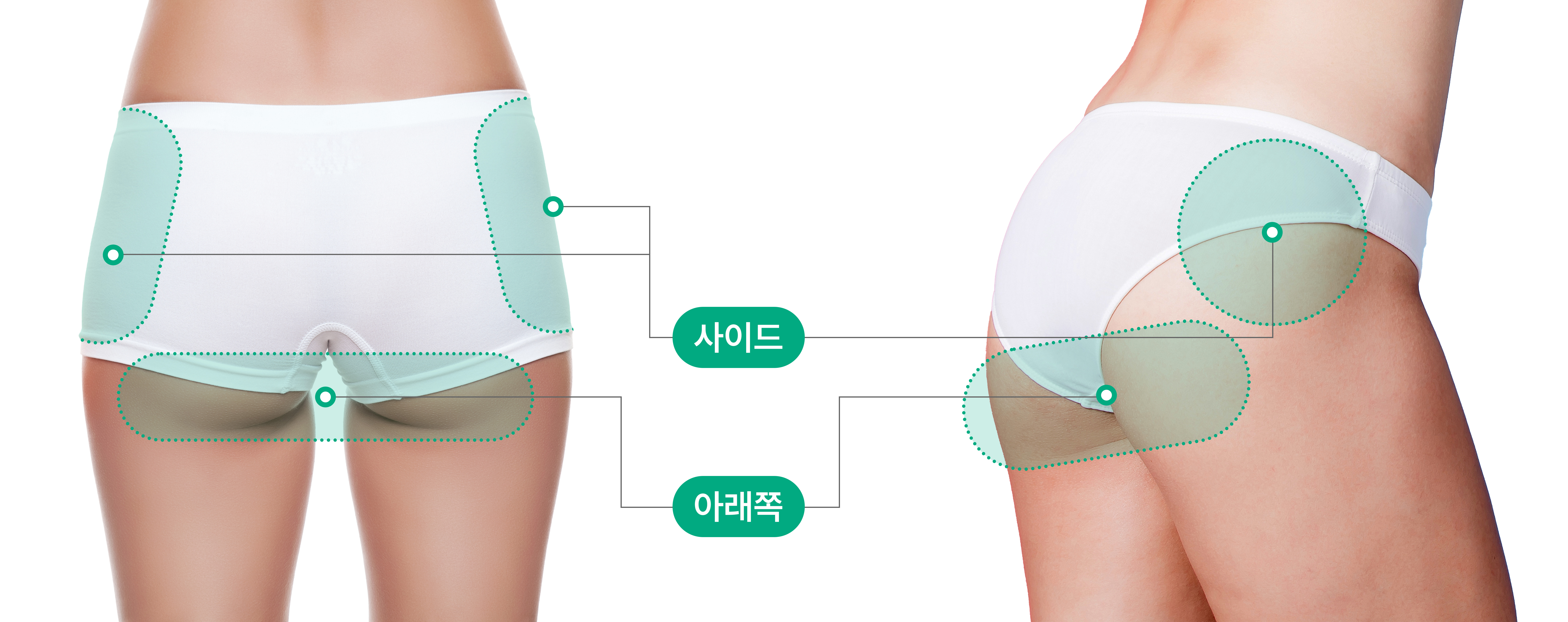 사이드, 아래쪽